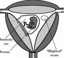 Bez jaja bez embrija. Može li fetalni jaje biti bez embrija?