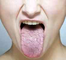 Ujutro, suha usta: uzroci, liječenje i posljedice