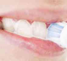 Zašto krvarenje zubnog mesa kod četkanja zuba: uzroci i tretman