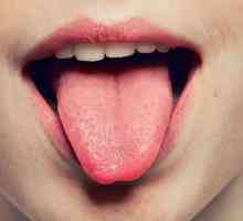 Zašto se jezik preklapao: uzroci, simptomi bolesti, liječenje