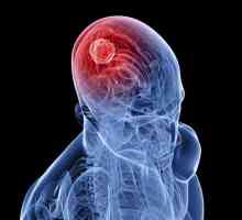 Posljedice encefalitis kod odraslih i djece