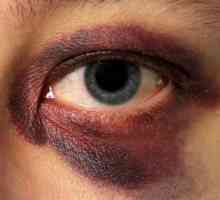 Oštećenja oka: uzroci i metode liječenja. Vrste ozljeda očiju