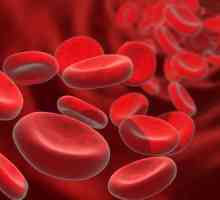 Povećana glukoza u krvi: što to znači, uzroci, simptomi i karakteristike liječenja