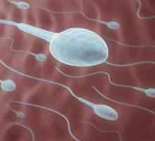 Povećana viskoznost sperme: uzroci i liječenje. Normalna viskoznost sperme