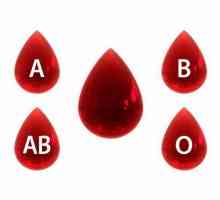Pravila za određivanje tipa krvi prema ABO sustavu