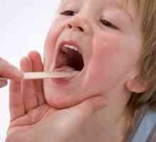 Pravilno liječenje adenoiditisa kod djece