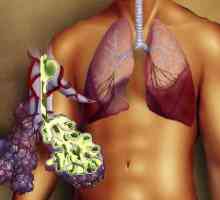 Desna strana upala pluća: uzroci, simptomi i liječenje
