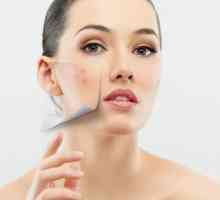 Uzrok unutarnje akne na licu. Kako ukloniti unutarnji bubuljica na licu?