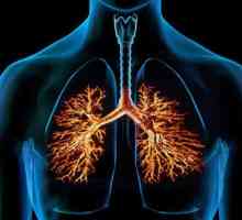 Uzroci i simptomi kroničnog opstruktivnog bronhitisa. Dijagnoza i liječenje