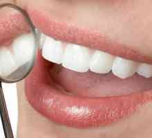 Zubni problemi: uzroci i preporuke liječnika