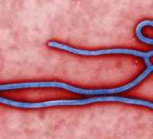 Sprječavanje vrućice Ebola. Ebola groznica: simptomi, liječenje