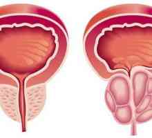 Prostatitis i kupka: je li moguće prostirati prostatitis