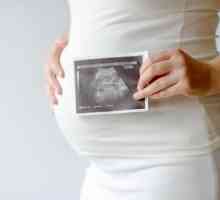 Psorijaza i trudnoća: liječenje, moguće posljedice