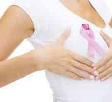 Rak dojke 4 faze: opis, uzroci, simptomi, dijagnoza i značajke liječenja