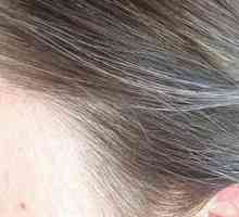 Rana sijeda kosa: uzroci i liječenje kod žena i muškaraca