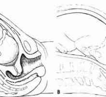 Otkrivanje cerviksa s dva prsta: kada roditi? Simptomi proširenja vrata maternice