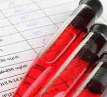 Dekodiranje biokemijskog testa krvi kod odraslih osoba (tablica). Biokemijski test krvi u djece:…