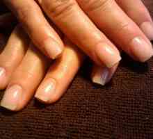 Stratifikacija noktiju na rukama: uzroci i liječenje