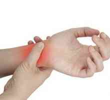Istezanje ligamenta ruke: simptomi i liječenje