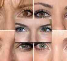 Različite oči čovjeka - što to znači?