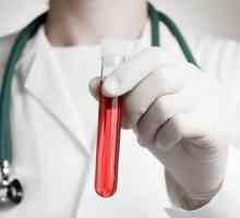 RDW - krvni test: transkript, norma
