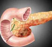 Reaktivni pankreatitis: simptomi i liječenje
