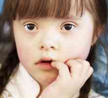 Dijete je spušteno - što to znači? Znakovi i simptomi Downovog sindroma