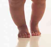 Dijete hoda na čarape: uzroci, posljedice