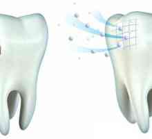 Remineralizacija zuba kod kuće: lijekovi