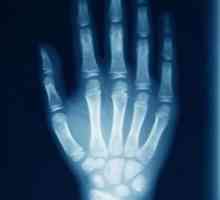 Ruke X-zrake za bolesti i ozljede