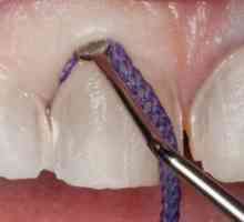 Retrakcijska nit u stomatologiji