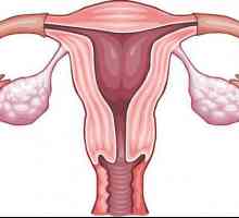 Retrovaskularizacija maternice: uzroci i liječenje