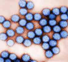Infekcija rotavirusa: simptomi kod odraslih i djece, liječenje