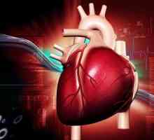 Pripreme srca: osnovne skupine