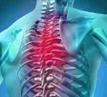 Osteokondroza prsnog koša: simptomi i liječenje lijekovima