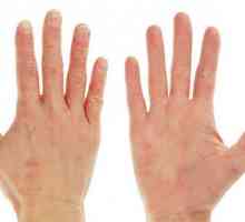 Koža na rukama: uzroci i liječenje