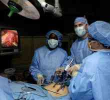 Nježna operacija - laparoskopija
