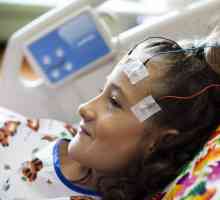 Simptomi epilepsije kod djeteta. Uzroci, dijagnoza, liječenje