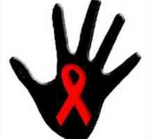 Simptomi HIV infekcije kod žena i muškaraca
