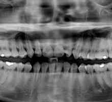 Koliko kanala u zubu gornje i donje čeljusti?