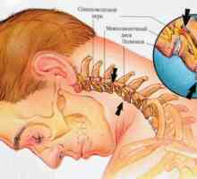 Zamjena cervikalnih kralježaka: simptomi, dijagnoza i liječenje