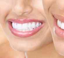 Prevencija stomatologije za prevenciju bolesti zuba i desni