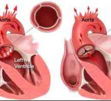 Struktura i funkcija srca. Kako djeluje ljudsko srce?
