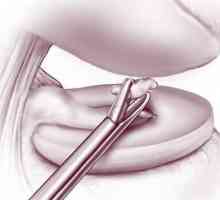 Articulated joint koljena: liječenje, uklanjanje