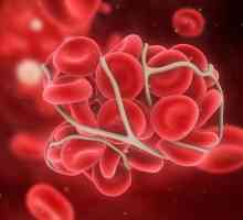 Koagulacija krvi i antikoagulacijski sustavi