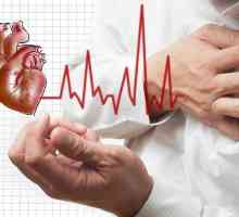 Transmuralni infarkt: uzroci i prognoza