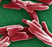 Tuberkuloza pluća diseminirana: simptomi i liječenje