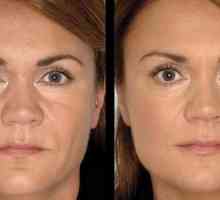 Ultrazvučno piling lica: akcija, indikacije, značajke i rezultat