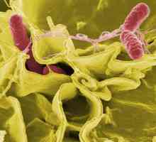 Konvencionalno patogene enterobakterije - što je to? Bolesti uzrokovane enterobakterijama