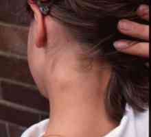 Limfni čvor na vratu djece povećava se. Što kažete?